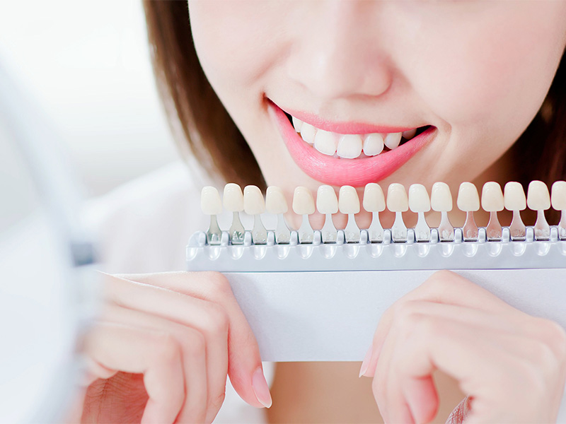 ホワイトニング